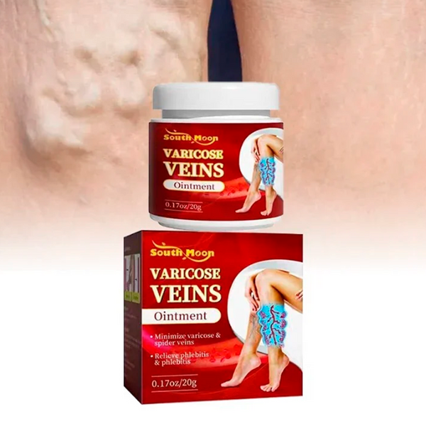 Varicose veins crema para varices